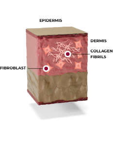 Cross section of tissue showing how Ultherapy® restructures the collagen fibrils that support the tissue, the third stage of neocollagenesis.