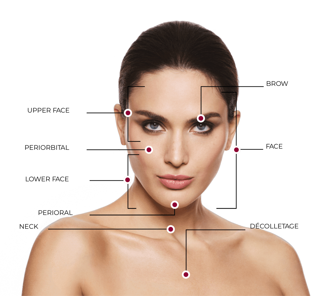 Woman with areas of the face and neck indicating where Ultherapy® can treat.