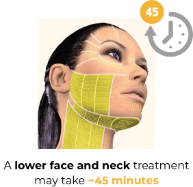 Image showing the areas of the face and neck that can be treated with Ultherapy® which may take ~90 minutes